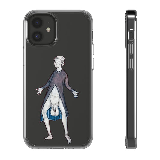Surprise! – Medieval Flashing Phone Case – Funny Historical Manuscript Art – Weird Vintage iPhone Cover – Bold Gift for Fans of the Bizarre